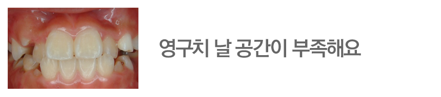 영구치 날 공간이 부족해요