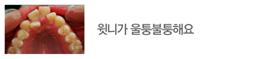 윗니가 울퉁불퉁해요