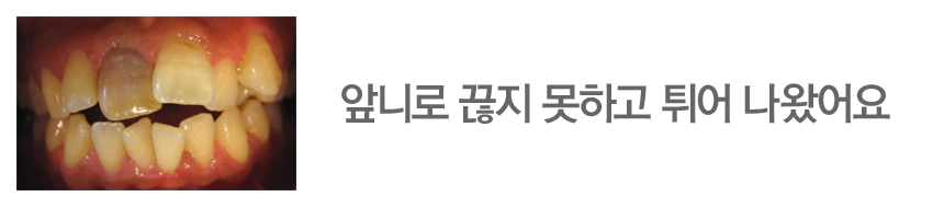 앞니로 끊지 못하고 튀어 나왔어요