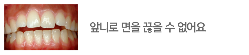 앞니로 면을 끊을 수 없어요