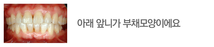 아래 앞니가 부채모양이에요